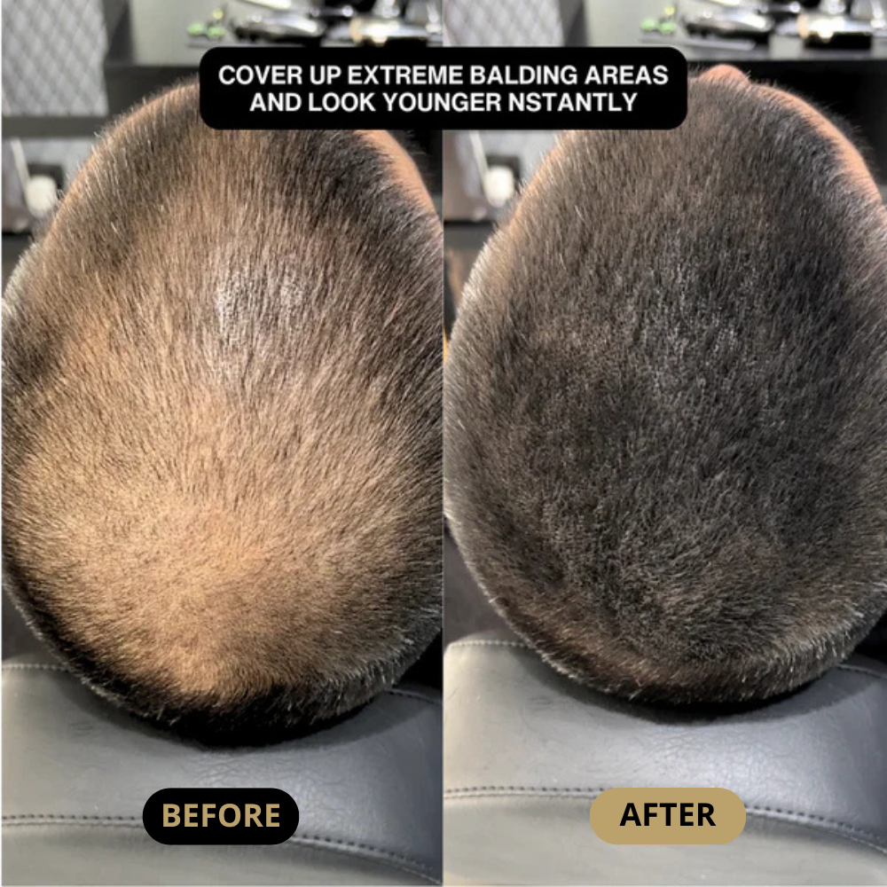 Hair Density Filler