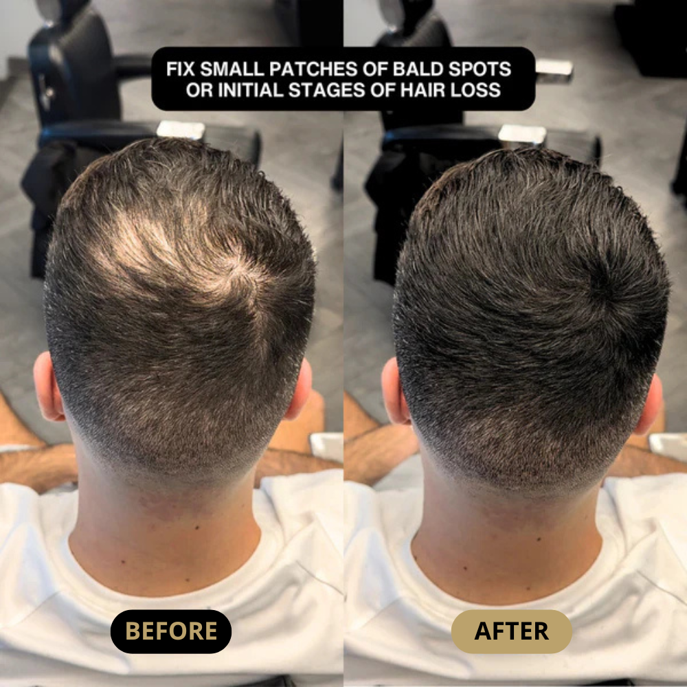 Hair Density Filler