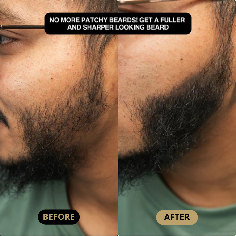 Hair Density Filler
