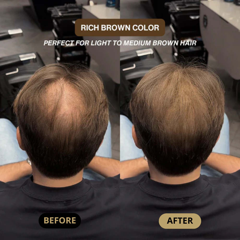Hair Density Filler