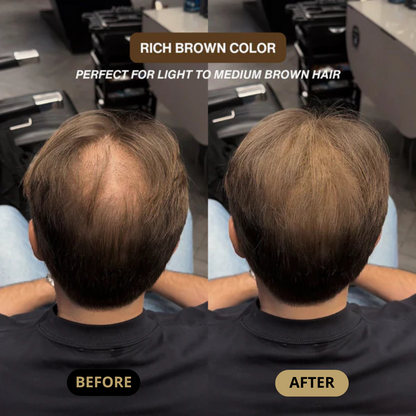 Hair Density Filler